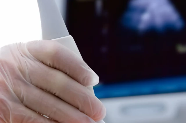 CHOICE Program - Treatment in Pregnancy CHOICE Program - Treatment in Pregnancy