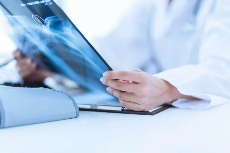 Doctor holding and examining Xray