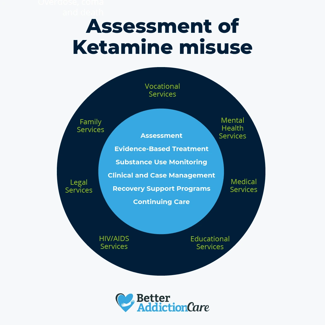 Ketamine Addiction Assessment