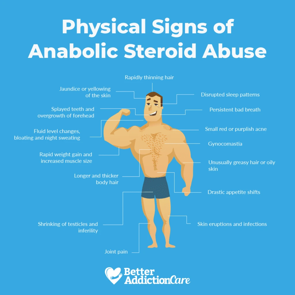 Physical Signs of Anabolic Steroid Abuse