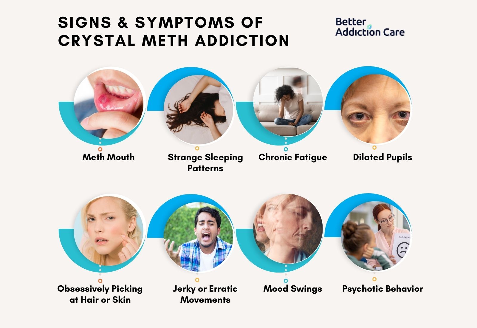Signs and Symptoms of Crystal Meth Addiction