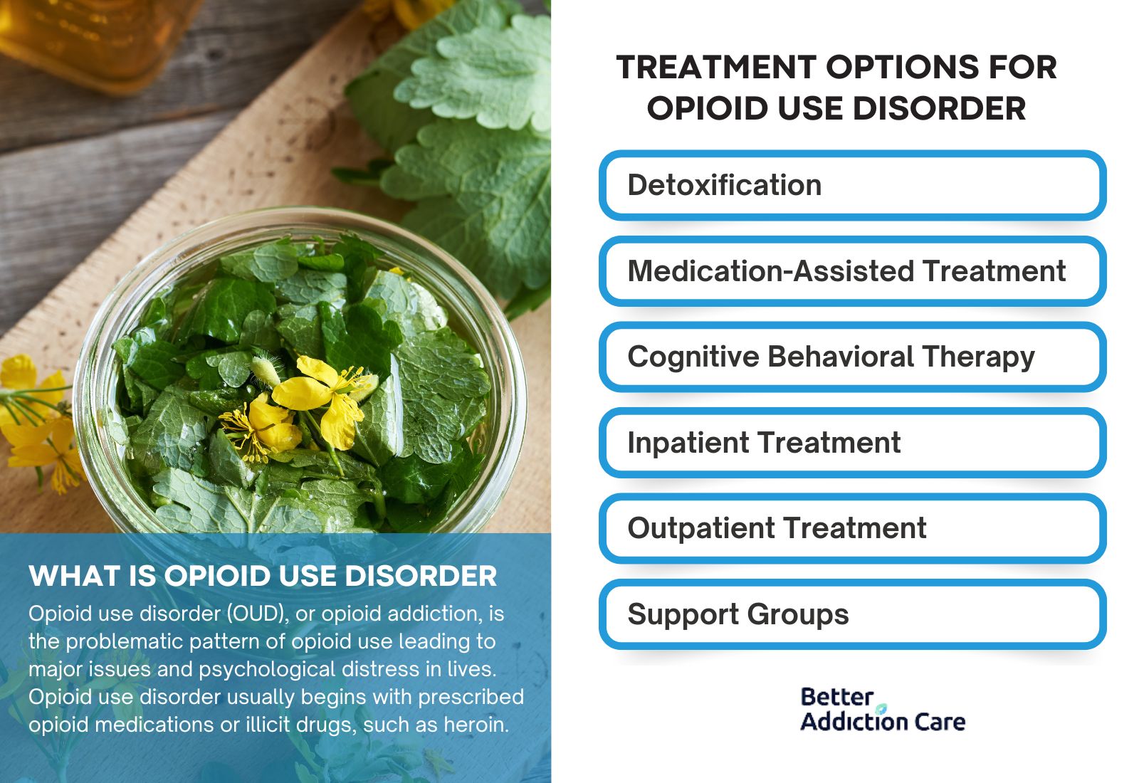 Treatment Options for Opioid Use Disorder
